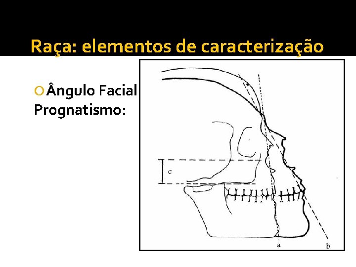 Raça: elementos de caracterização ngulo Facial: Prognatismo: 