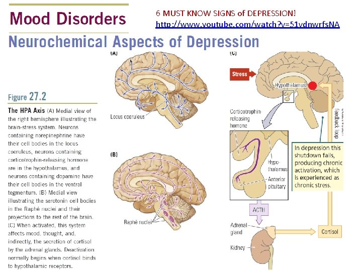 6 MUST KNOW SIGNS of DEPRESSION! http: //www. youtube. com/watch? v=51 vdnwrfs. NA 