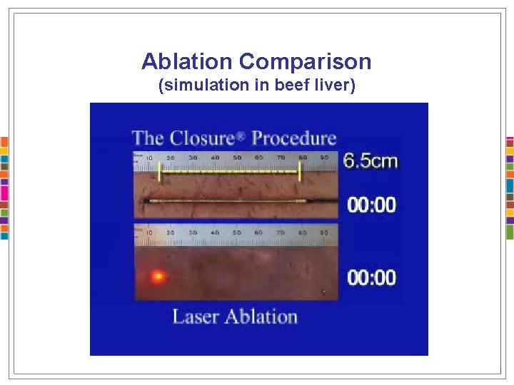 Ablation Comparison (simulation in beef liver) 