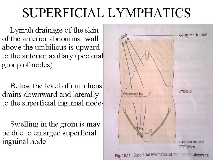 SUPERFICIAL LYMPHATICS Lymph drainage of the skin of the anterior abdominal wall above the