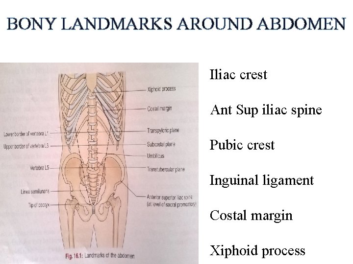 BONY LANDMARKS AROUND ABDOMEN Iliac crest Ant Sup iliac spine Pubic crest Inguinal ligament