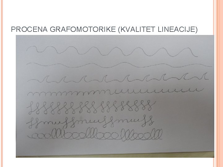 PROCENA GRAFOMOTORIKE (KVALITET LINEACIJE) 