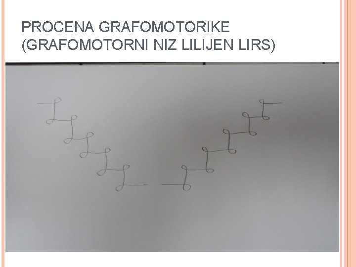 PROCENA GRAFOMOTORIKE (GRAFOMOTORNI NIZ LILIJEN LIRS) 