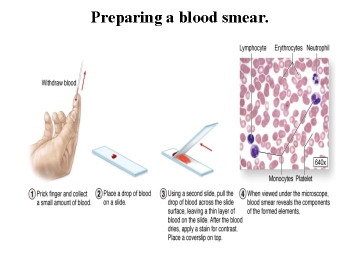 Preparing a blood smear. 