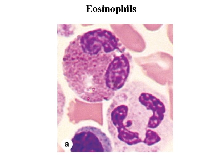 Eosinophils 