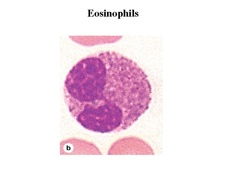 Eosinophils 