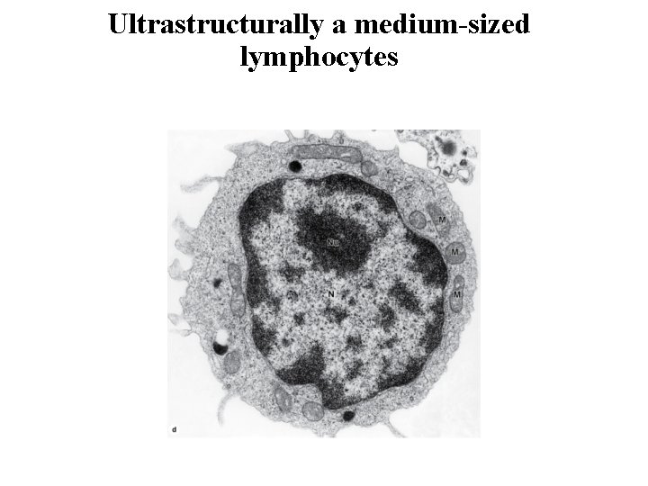 Ultrastructurally a medium-sized lymphocytes 