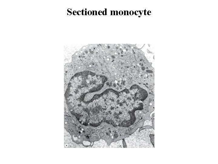 Sectioned monocyte 