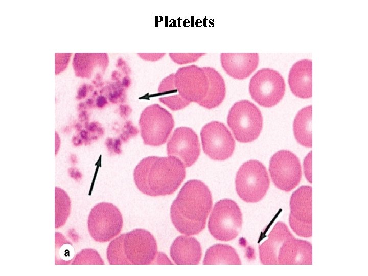 Platelets 