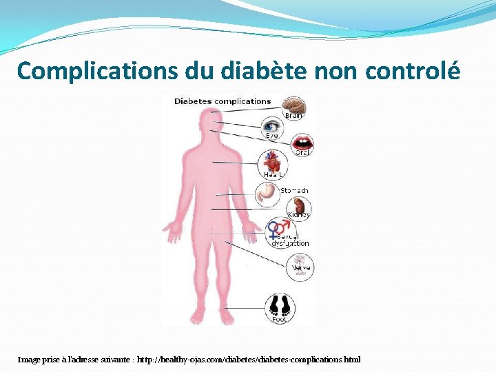 Complications du diabète non controlé Image prise à l'adresse suivante : http: //healthy-ojas. com/diabetes-complications. Complications du diabète non controlé Image prise à l'adresse suivante : http: //healthy-ojas. com/diabetes-complications.