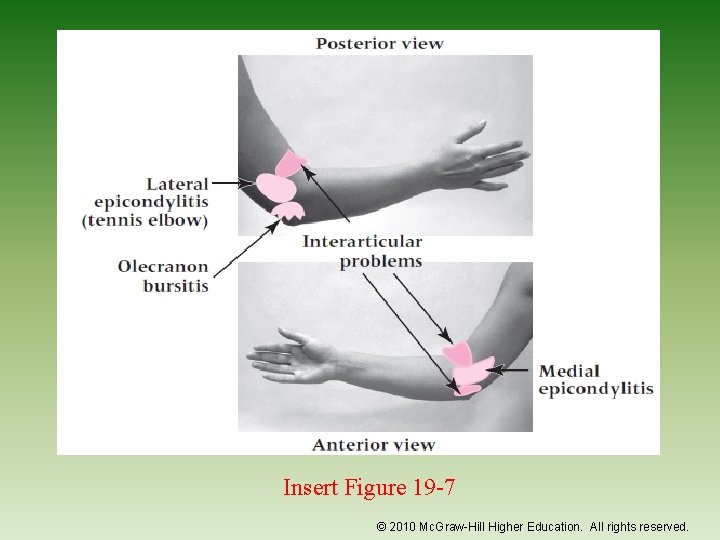 Insert Figure 19 -7 © 2010 Mc. Graw-Hill Higher Education. All rights reserved. 