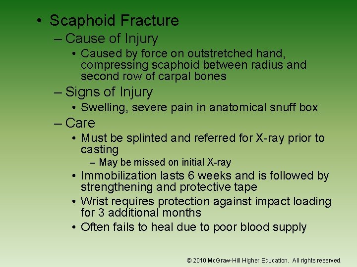  • Scaphoid Fracture – Cause of Injury • Caused by force on outstretched