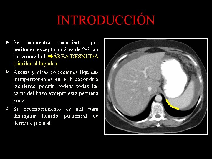 INTRODUCCIÓN Ø Se encuentra recubierto por peritoneo excepto un área de 2 -3 cm