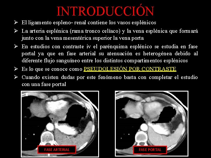 INTRODUCCIÓN Ø El ligamento espleno- renal contiene los vasos esplénicos Ø La arteria esplénica