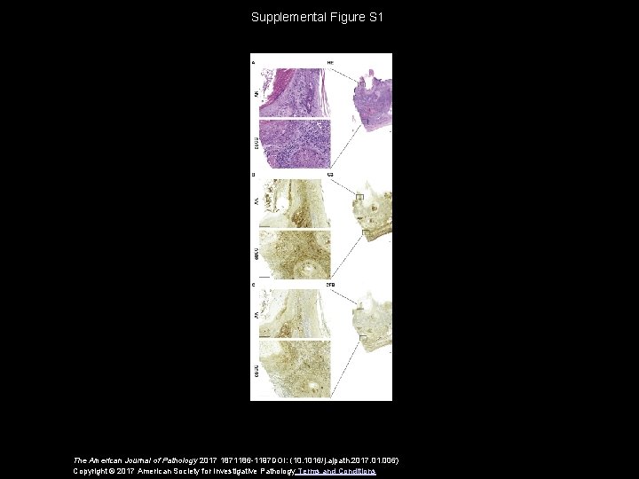 Supplemental Figure S 1 The American Journal of Pathology 2017 1871186 -1197 DOI: (10.