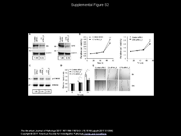 Supplemental Figure S 2 The American Journal of Pathology 2017 1871186 -1197 DOI: (10.