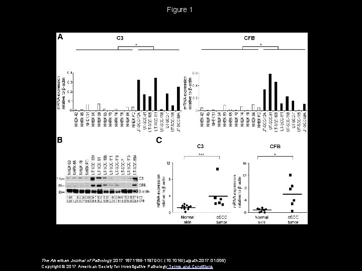 Figure 1 The American Journal of Pathology 2017 1871186 -1197 DOI: (10. 1016/j. ajpath. Figure 1 The American Journal of Pathology 2017 1871186 -1197 DOI: (10. 1016/j. ajpath.