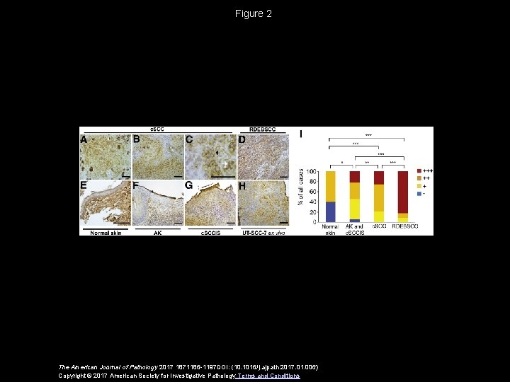 Figure 2 The American Journal of Pathology 2017 1871186 -1197 DOI: (10. 1016/j. ajpath.