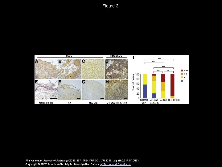 Figure 3 The American Journal of Pathology 2017 1871186 -1197 DOI: (10. 1016/j. ajpath. Figure 3 The American Journal of Pathology 2017 1871186 -1197 DOI: (10. 1016/j. ajpath.