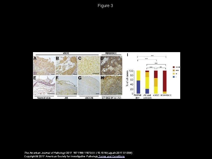 Figure 3 The American Journal of Pathology 2017 1871186 -1197 DOI: (10. 1016/j. ajpath.