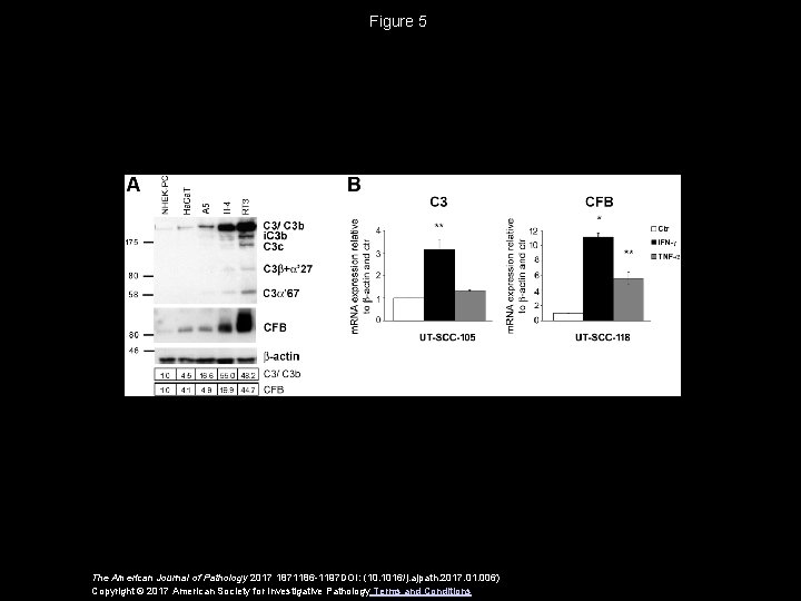 Figure 5 The American Journal of Pathology 2017 1871186 -1197 DOI: (10. 1016/j. ajpath. Figure 5 The American Journal of Pathology 2017 1871186 -1197 DOI: (10. 1016/j. ajpath.