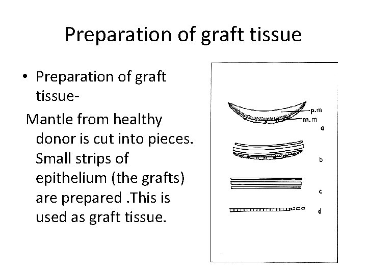 Preparation of graft tissue • Preparation of graft tissue Mantle from healthy donor is