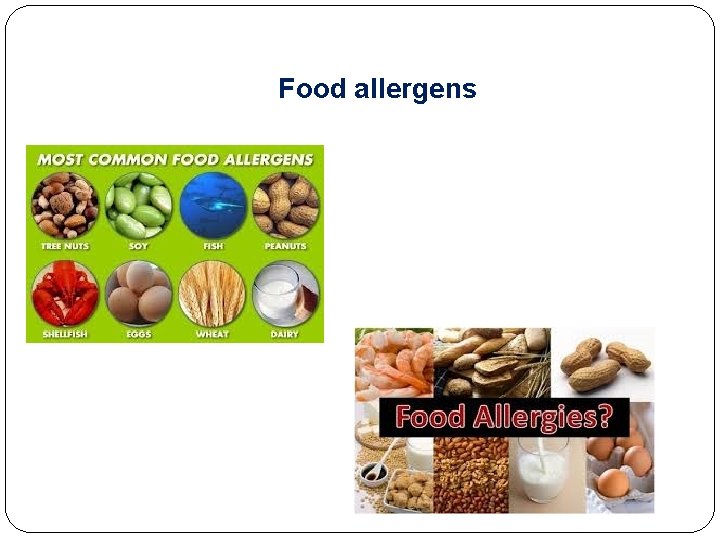 Food allergens 