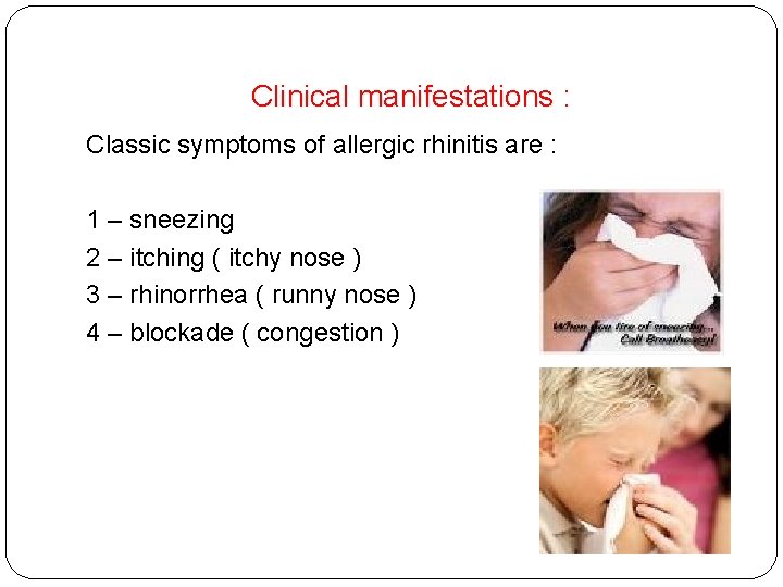 Clinical manifestations : Classic symptoms of allergic rhinitis are : 1 – sneezing 2