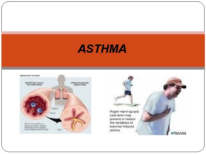 ASTHMA 