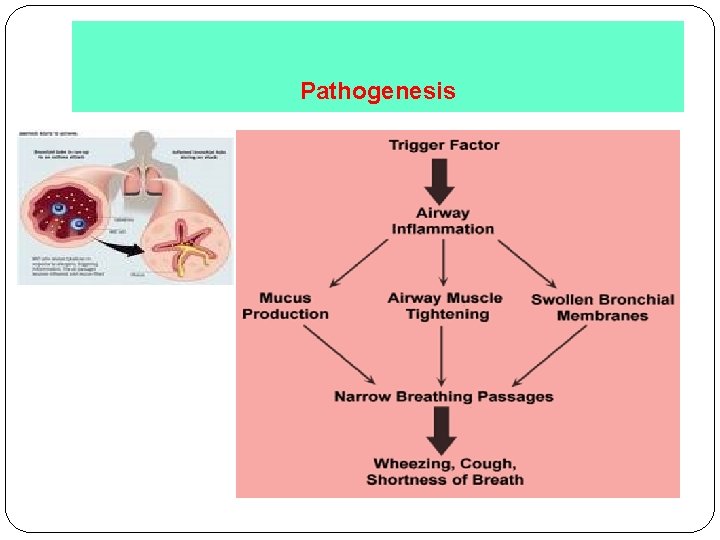 Pathogenesis 