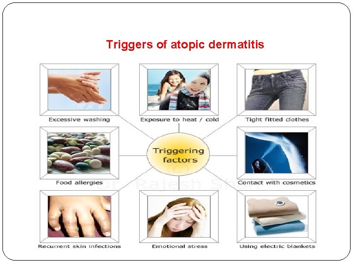 Triggers of atopic dermatitis 