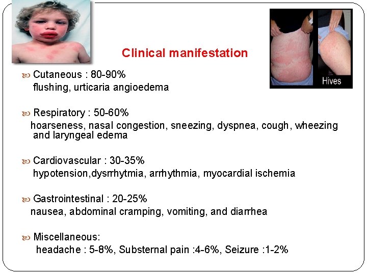 Clinical manifestation Cutaneous : 80 -90% flushing, urticaria angioedema Respiratory : 50 -60% hoarseness,