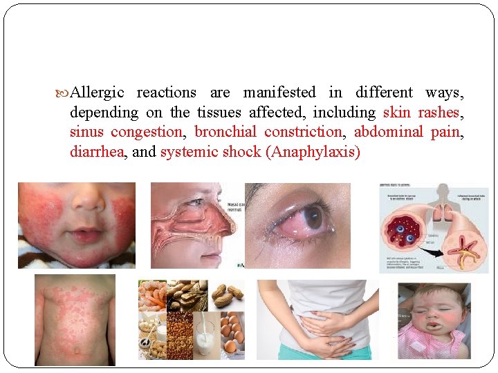  Allergic reactions are manifested in different ways, depending on the tissues affected, including