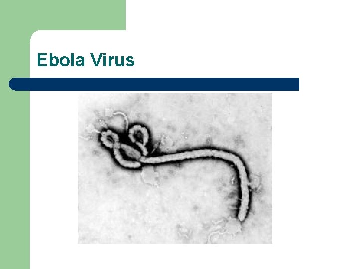 Ebola Virus 