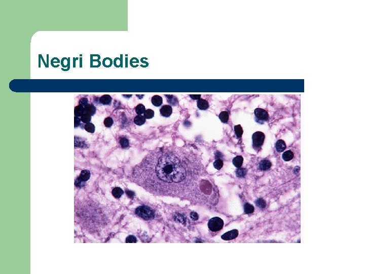 Negri Bodies 