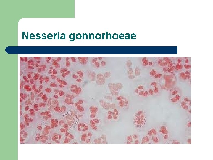 Nesseria gonnorhoeae 