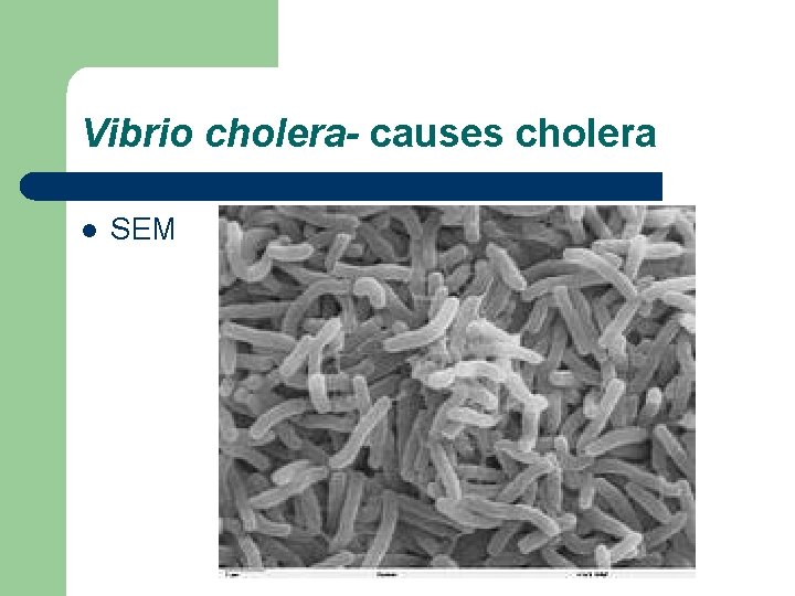 Vibrio cholera- causes cholera l SEM 