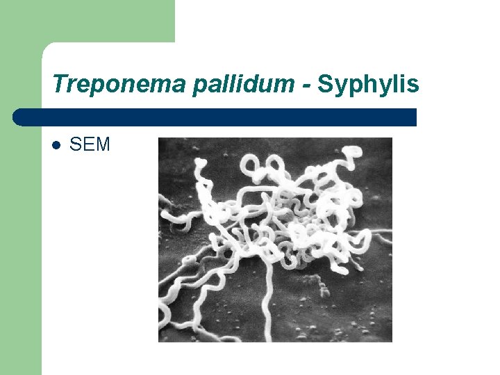 Treponema pallidum - Syphylis l SEM 