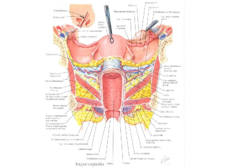 Rugae vaginales 