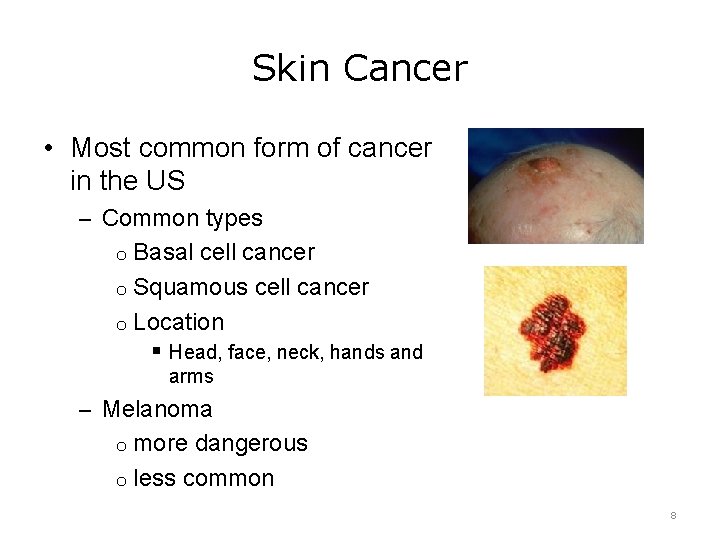 Skin Cancer • Most common form of cancer in the US – Common types