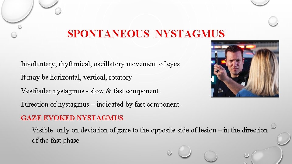 SPONTANEOUS NYSTAGMUS Involuntary, rhythmical, oscillatory movement of eyes It may be horizontal, vertical, rotatory