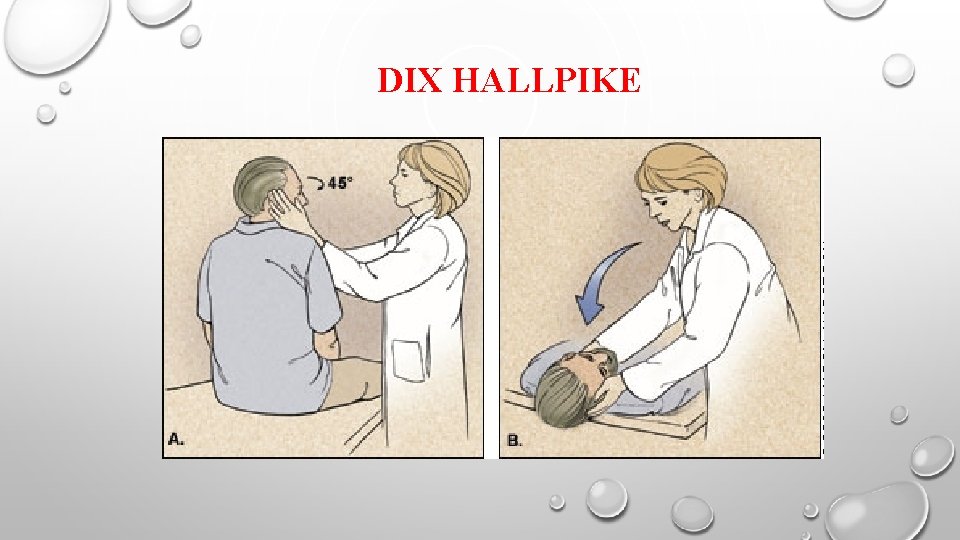 DIX HALLPIKE 