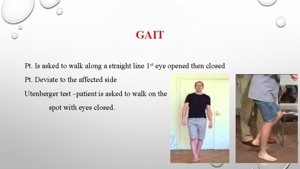 GAIT Pt. Is asked to walk along a straight line 1 st eye opened