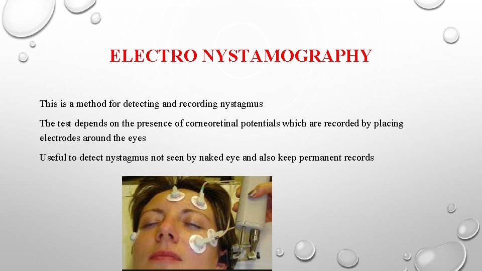 ELECTRO NYSTAMOGRAPHY This is a method for detecting and recording nystagmus The test depends