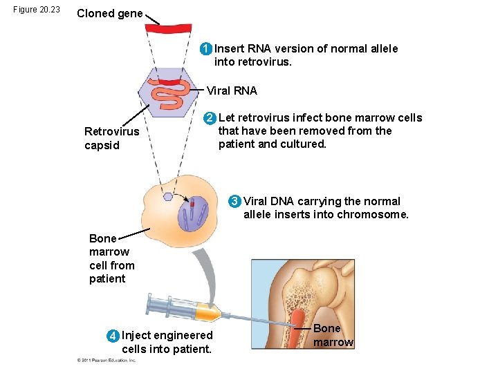 Figure 20. 23 Cloned gene 1 Insert RNA version of normal allele into retrovirus.