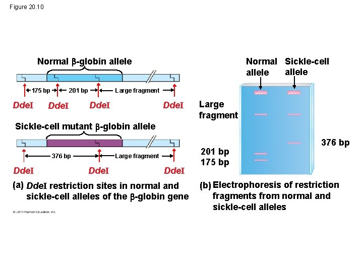 Figure 20. 10 Normal -globin allele 175 bp Dde. I Large fragment 201 bp