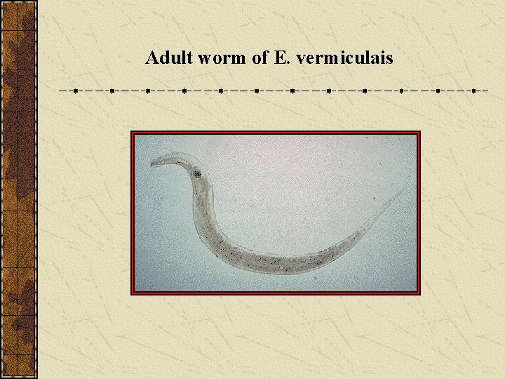 Adult worm of E. vermiculais 