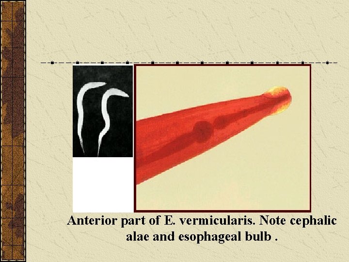 Anterior part of E. vermicularis. Note cephalic alae and esophageal bulb. 