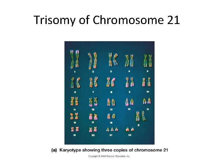 Trisomy of Chromosome 21 