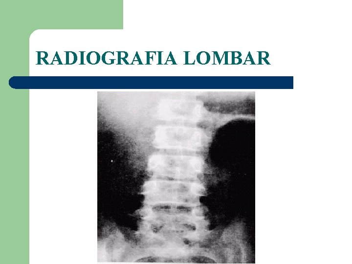 RADIOGRAFIA LOMBAR 